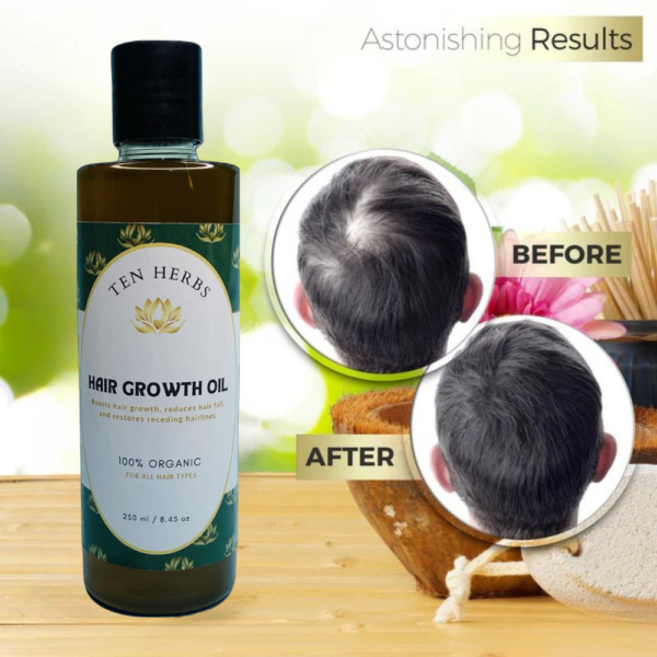 Ten Herbs Hair Growth Oil Guaranteed Results