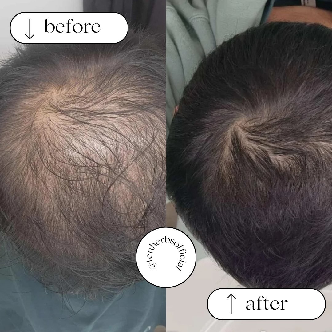 Before and after photos from Abdul Muqeet