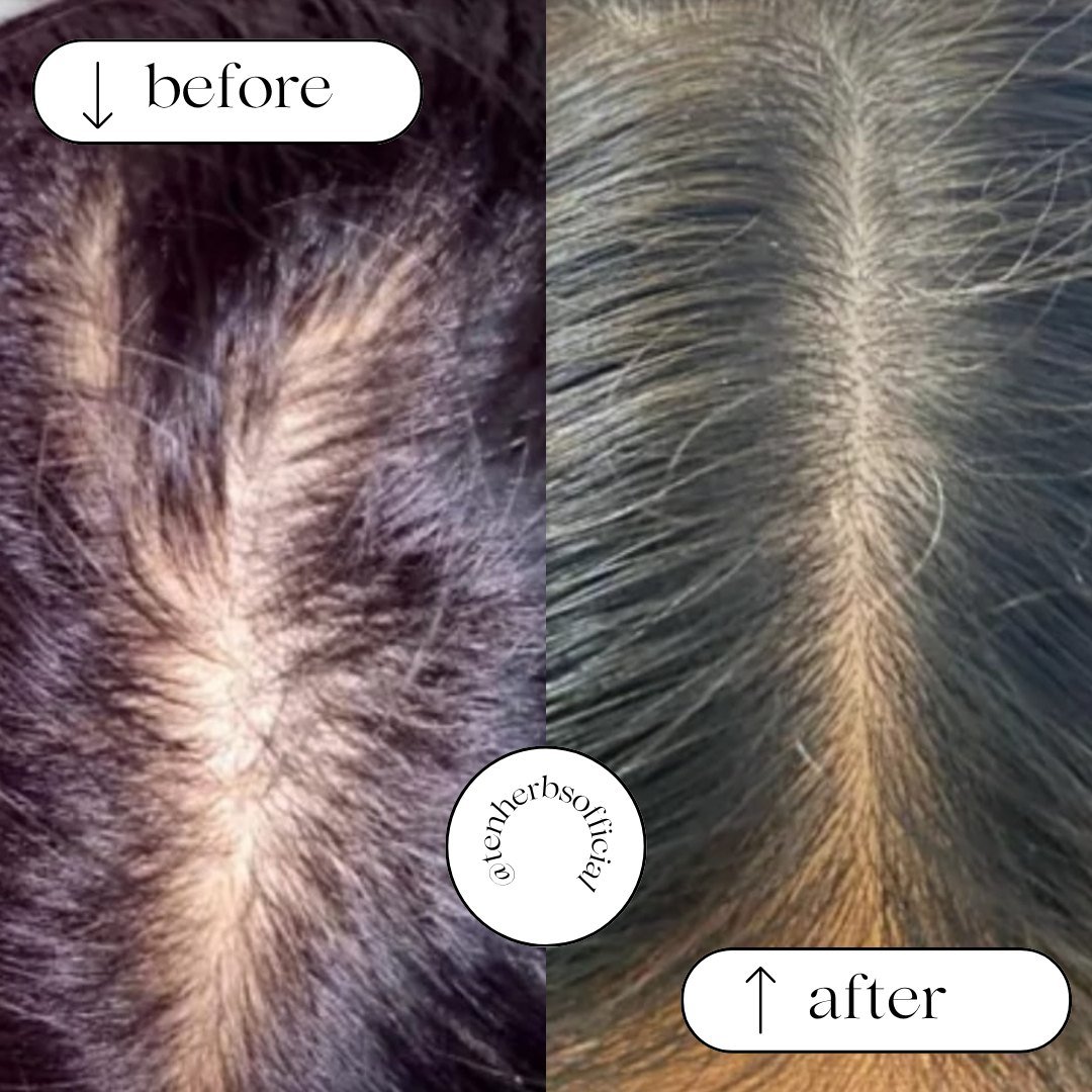 Before and after photos from Mrs. Hashim