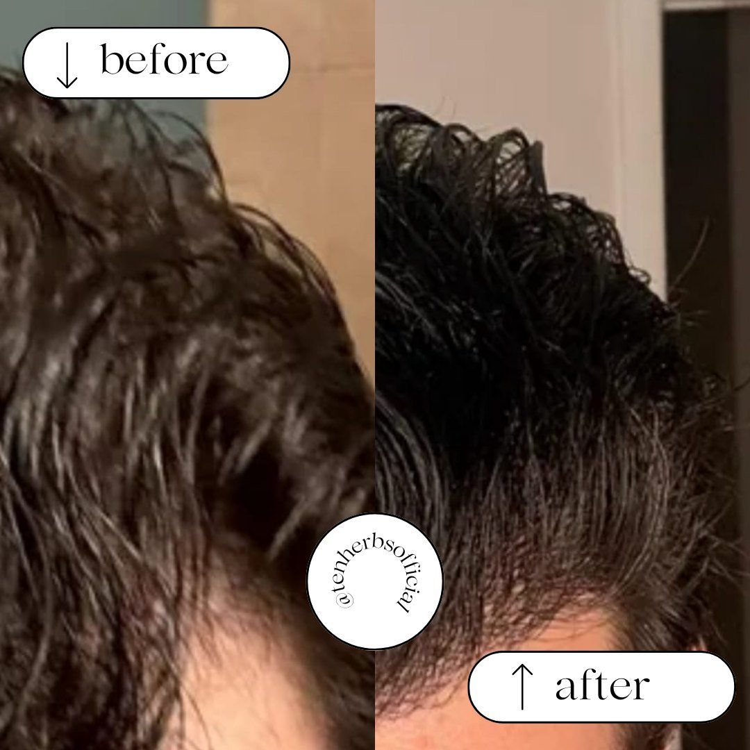 Before and after photos from Taimoor